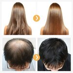 Hair Regrowth Oil - Jojoba Oil Blocker with Vitamins & Private Label