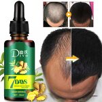 Hair Growth Oil - Ginger Essential Oils Anti Hair Loss & Private Label