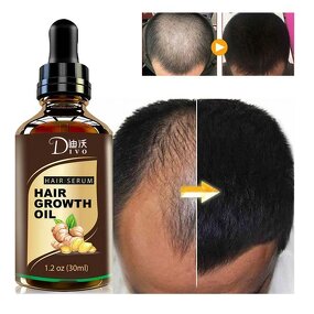 Hair Growth Oil - 30ml Natural Organic with Ginger & OEM