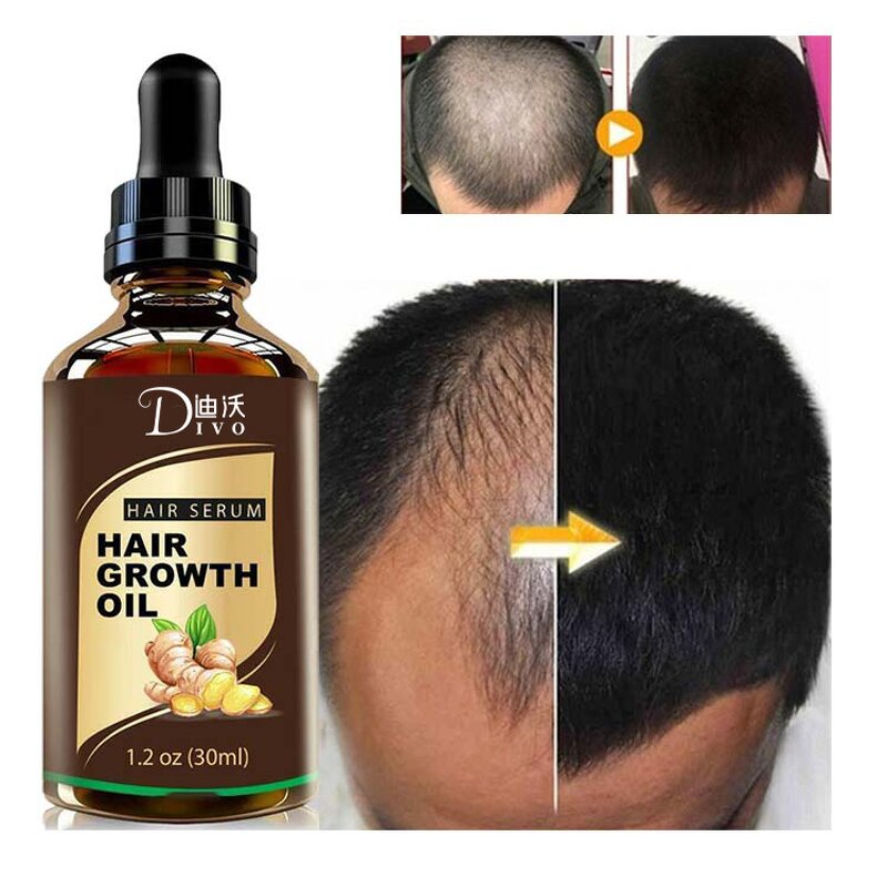 Hair Growth Oil - 30ml Natural Organic with Ginger & OEM