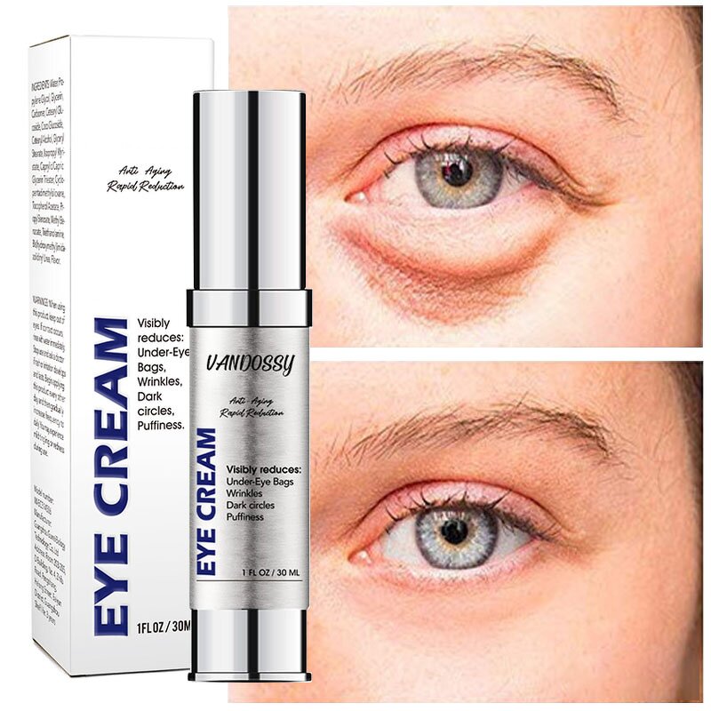 Eye Cream - Smudge-on Eye Bag Removing Anti-Aging & ODM