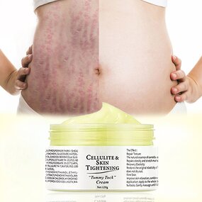 Maternity Cream - Skin Repair Stretch Mark Removal & OEM