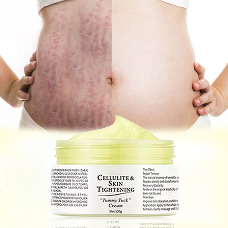 Maternity Cream - Skin Repair Stretch Mark Removal & OEM