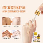 Dark Knuckles Whitening Serum Manufacturer - Private Label Fast Hand Elbow Knee Whitening Serum