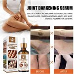 Dark Knuckles Whitening Serum Manufacturer - Fast Stain Remover Hand Knuckle Elbow Knee Whitening