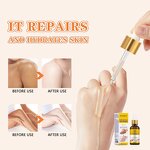 Dark Knuckles Whitening Serum Manufacturer - Private Label Triple White Fast Whitening Pigment Remover