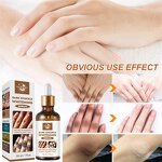 Dark Knuckles Whitening Serum Manufacturer - Fast Stain Remover Hand Knuckle Elbow Knee Whitening