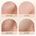 Facial Cleanser - BIOAQUA Organic - Anti-Acne Cleansing Mousse Pore Tea Tree Aloe Vera Foam