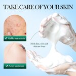 Facial Cleanser - BIOAQUA Organic - Anti-Acne Cleansing Mousse Pore Tea Tree Aloe Vera Foam