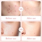 Facial Cleanser - BIOAQUA Private Label - Rose Hyaluronic Acid Pore Deep Cleansing Moisturizing Vegan