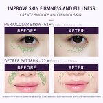 Skin Care Gift Set - High Quality Ingredients - Whitening Moisturizing Repair Organic