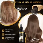 Hair Spray Manufacturer - Private Label Pure Vegan Black Rice Water Regrowth Anti Hair Loss