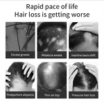 Hair Oil Manufacturer - Popular Growth Private Label Rosemary Essential Oil Large Capacity