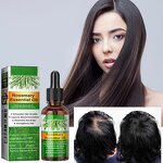 Hair Oil Manufacturer - Custom 100% Natural Organic Scalp Rosemary Essential Oil Men Women