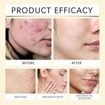 Cleansing Pads Manufacturer - Kojic Acid Turmeric 50 Pcs Exfoliation Vitamin B5 Vitamin C