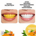 Teeth Whitening Powder Manufacturer - Natural Professional Formula Harmless Fresh Breath Curcumin Turmeric Teeth Whitening Powder