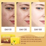 Bath Soap Manufacturer - Wholesale Natural Turmeric Lemon Vegan Anti-Acne Whitening Handmade 100g Soap