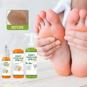 Foot Spray Manufacturer - Exfoliating Spray Foot Dead Skin Callus Heel Elbow Knee Care Spray