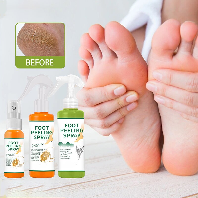 Foot Spray Manufacturer - Exfoliating Spray Foot Dead Skin Callus Heel Elbow Knee Care Spray