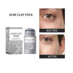 Face Mask Manufacturer - Private Label Skincare Organic Acne Clay Removal Pore Shrinking Face Body Mask