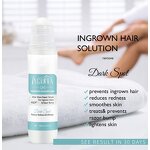 After Shave Serum Manufacturer - Private Label Natural Formula Remove Dark Spot After Shave Razor Bumps Treatment Solution Roll on