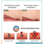 After Shave Serum Manufacturer - Private Label Natural Formula Remove Dark Spot After Shave Razor Bumps Treatment Solution Roll on