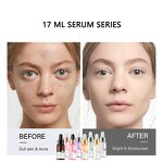 Face Serum Manufacturer - OEM Private Label Skin Products Hyaluronic Acid Nicotinamide Anti-Aging Vitamin C Serum