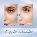 Eye Mask Manufacturer - Lady Moisturizing Lifting Lines Lightening Dark Circles Hydrogel