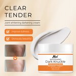 Whitening Cream Manufacturer - Dark Knuckle for Knees and Elbows Moisturizing Strong Joint