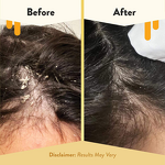 Hair Oil Manufacturer - Private Label Honey Infused Natural Soothing Scalp Deeply Nourish