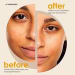 Soap Bar Manufacturer - Handmade Turmeric for Dark Spots with Vitamin C Glowing