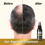 Hair Growth Serum Manufacturer - Black Rice Water Leave in Spray for Longer Thicker Hair