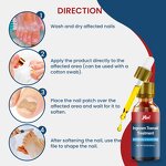 Ingrown Toenail Treatment Manufacturer - Pain Reliever Corrector Patches Removal Kit with File