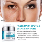 Dark Spot Corrector Cream Manufacturer - Moisturizer Remover Sun Spot Age Spot for Men Women