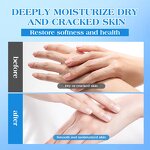 Urea Cream Manufacturer - 42% for Dry & Cracked Skin Foot & Hand Moisturizer Repair