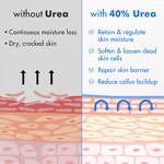 Urea Cream Manufacturer - 40 Percent for Feet Plus 2% Salicylic Acid Maximum Strength