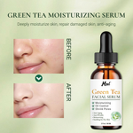 Face Serum Manufacturer - Green Tea Moisturizing Oil Control Skin Soothing Shrink Pores