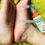 Foot Peeling Spray Manufacturer - Instant Orange Oil Antifungal That Remove Dead Skin