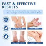 Urea Cream Manufacturer - 40 Percent for Feet Foot Repair Lotion Maximum Strength