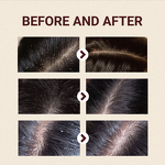 Shampoo Manufacturer - Ginseng Revitalizing for Healthy Strong Hair Nourishment