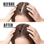 Ginger Treatment Oil Manufacturer - for Hair Loss Enhance Elasticity Smooth Silky Thicker