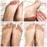 Foot Peeling Spray Manufacturer - Instant Orange Oil Antifungal That Remove Dead Skin