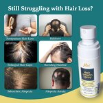 Hair Growth Oil Spray Manufacturer - Natural Batana Rosemary Serum Biotin Caffeine Scalp Care