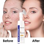 Facial Cleanser Manufacturer - Whitening Deep Cleaning - HEARTLEAF Tea Tree Salicylic Acid