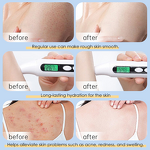 Body Cream Manufacturer - Good Quality Whitening Face Body - Lightening Cream Body Butter