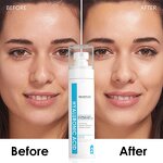 Skin Toner Manufacturer - Hyaluronic Acid Skincare - Whitening Peeling Eraser Blemishes