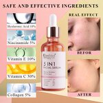 Vitamin C Serum Manufacturer - Hyaluronic Acid Niacinamide - 5 in 1 Whitening Anti Age