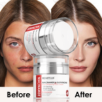 Whitening Cream Manufacturer - Alpha Arbutin Niacinamide - Dark Spot Women Cream