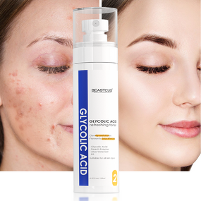 Skin Toner Manufacturer - Custom 7% Glycolic Acid - 120ml/100ml Moisturizing