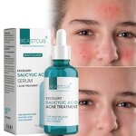 Acne Treatment Serum Manufacturer - Niacinamide Glycolic Acid 1.5% - Salicylic Acid